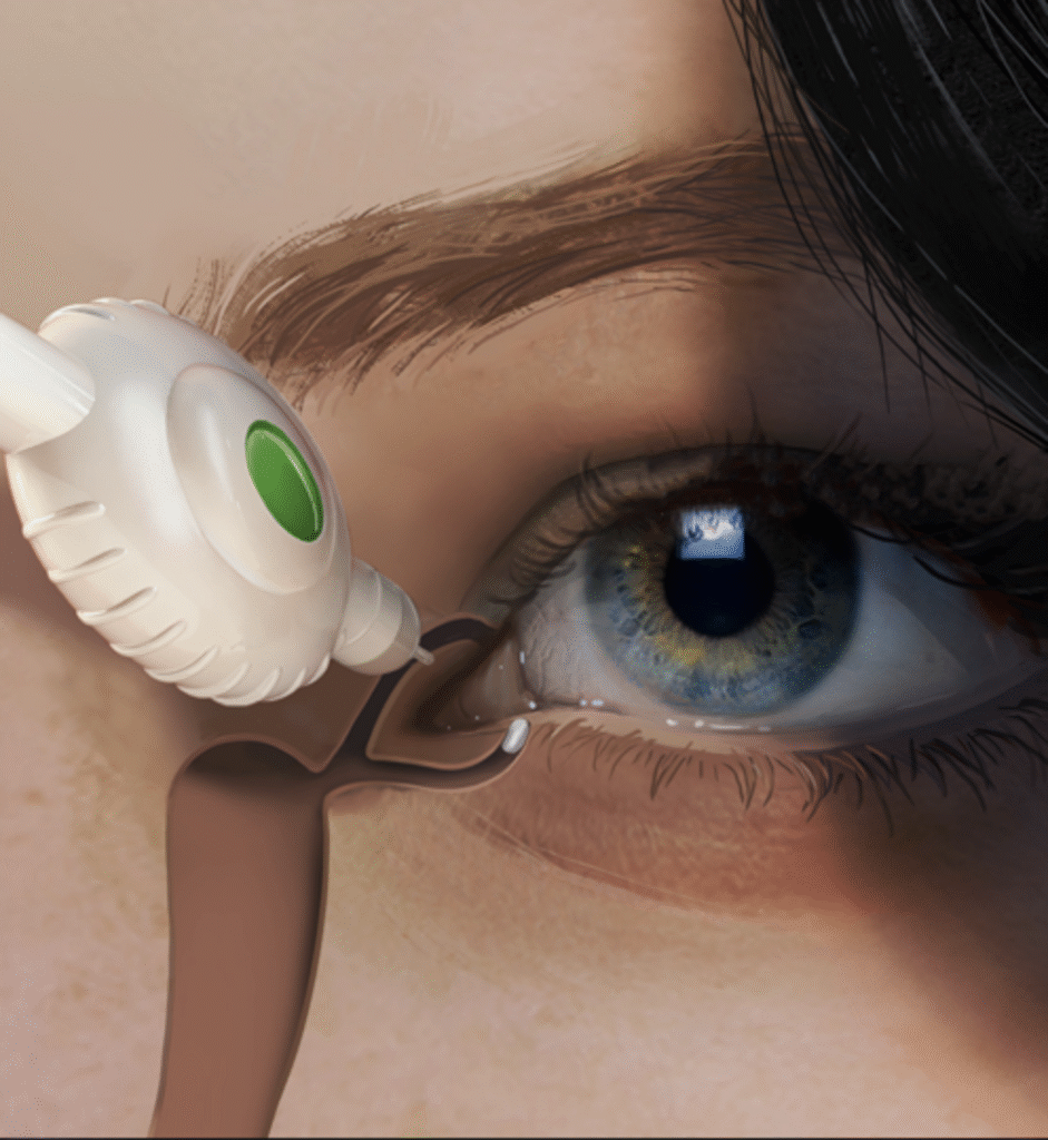 Ocular Drug Delivery prototype delivering liquid into the eye upon pressing on it