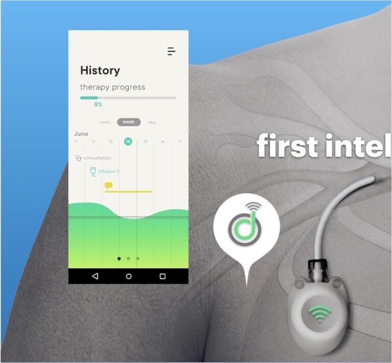 implantable oncology sensor iOLifeScience